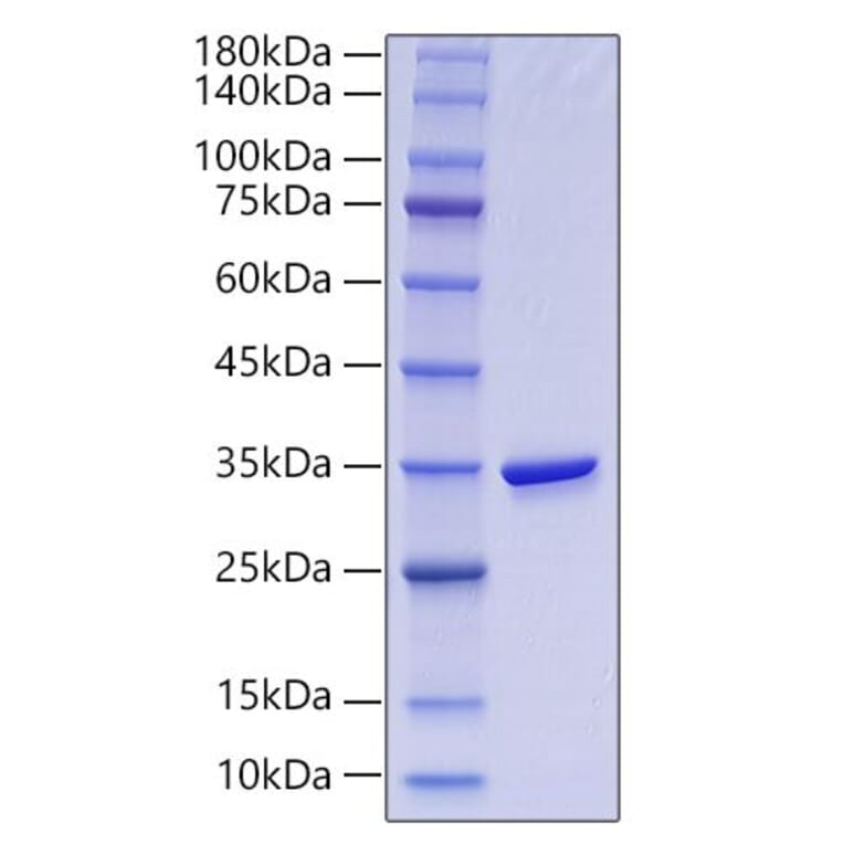 SDS-PAGE - Recombinant Human GGH Protein (N-terminal His Tag) (A330703) - Antibodies.com