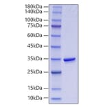 SDS-PAGE - Recombinant Human GGH Protein (N-terminal His Tag) (A330703) - Antibodies.com