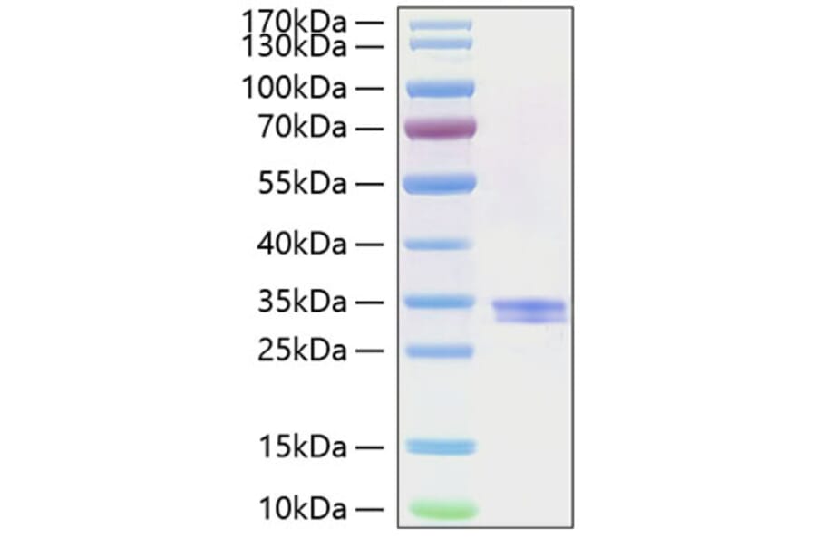 SDS-PAGE - Recombinant Human GILT Protein (C-terminal His Tag) (A330705) - Antibodies.com