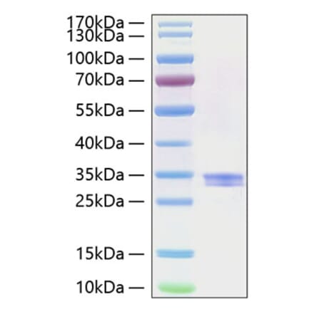 SDS-PAGE - Recombinant Human GILT Protein (C-terminal His Tag) (A330705) - Antibodies.com