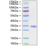 SDS-PAGE - Recombinant Human GILT Protein (C-terminal His Tag) (A330705) - Antibodies.com