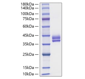 SDS-PAGE - Recombinant Human GIP Protein (N-terminal Human Fc Tag) (A330706) - Antibodies.com