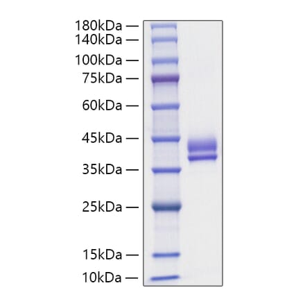 SDS-PAGE - Recombinant Human GIP Protein (N-terminal Human Fc Tag) (A330706) - Antibodies.com