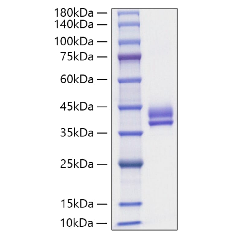 SDS-PAGE - Recombinant Human GIP Protein (N-terminal Human Fc Tag) (A330706) - Antibodies.com
