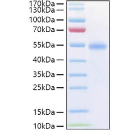 SDS-PAGE - Recombinant Human GITR Protein (C-terminal Human Fc and His Tag) (A330707) - Antibodies.com