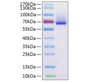 SDS-PAGE - Recombinant Human Glypican 1 Protein (C-terminal His Tag) (A330709) - Antibodies.com