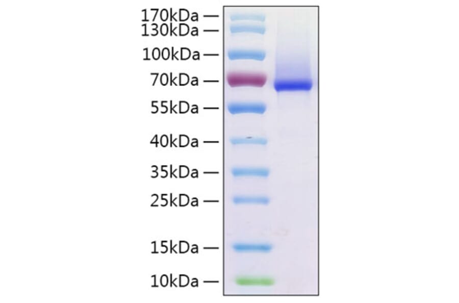 SDS-PAGE - Recombinant Human Glypican 1 Protein (C-terminal His Tag) (A330709) - Antibodies.com