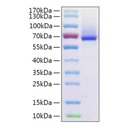 SDS-PAGE - Recombinant Human Glypican 1 Protein (C-terminal His Tag) (A330709) - Antibodies.com