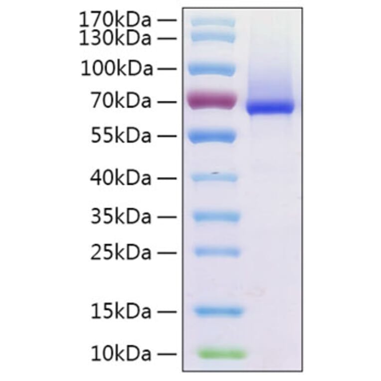 SDS-PAGE - Recombinant Human Glypican 1 Protein (C-terminal His Tag) (A330709) - Antibodies.com