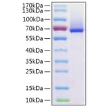 SDS-PAGE - Recombinant Human Glypican 1 Protein (C-terminal His Tag) (A330709) - Antibodies.com