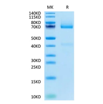Tris-Bis PAGE - Recombinant Human Glypican 3 Protein (Biotin) (C-terminal His and Avi Tag) (A330710) - Antibodies.com