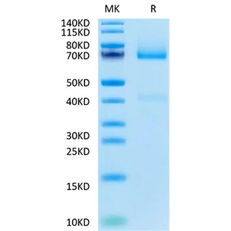 Tris-Bis PAGE - Recombinant Human Glypican 3 Protein (Biotin) (C-terminal His and Avi Tag) (A330710) - Antibodies.com