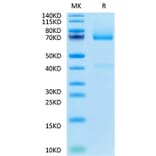 Tris-Bis PAGE - Recombinant Human Glypican 3 Protein (Biotin) (C-terminal His and Avi Tag) (A330710) - Antibodies.com
