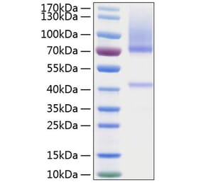 SDS-PAGE - Recombinant Human Glypican 3 Protein (C-terminal His Tag) (A330711) - Antibodies.com