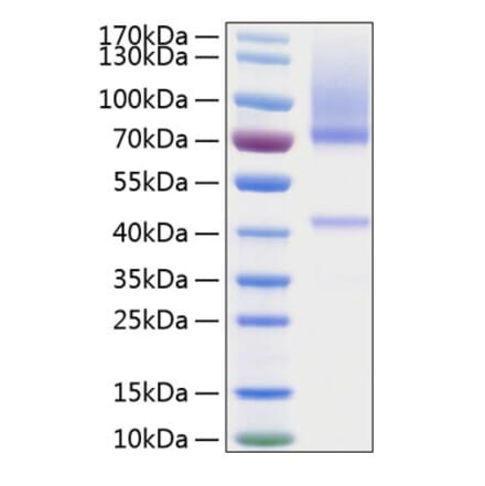 SDS-PAGE - Recombinant Human Glypican 3 Protein (C-terminal His Tag) (A330711) - Antibodies.com