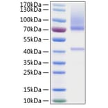 SDS-PAGE - Recombinant Human Glypican 3 Protein (C-terminal His Tag) (A330711) - Antibodies.com
