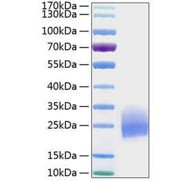 SDS-PAGE - Recombinant Human GM-CSF Protein (C-terminal His Tag) (A330712) - Antibodies.com