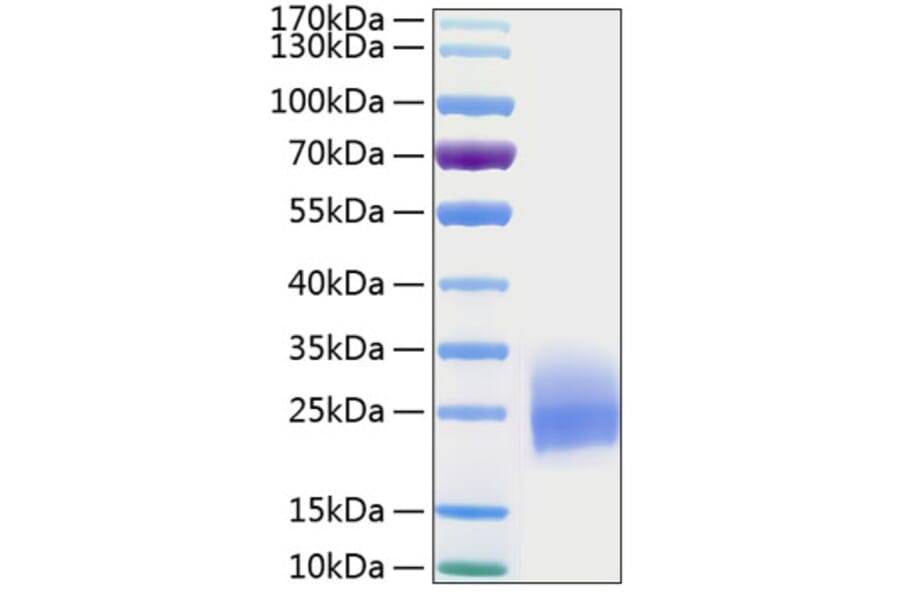 SDS-PAGE - Recombinant Human GM-CSF Protein (C-terminal His Tag) (A330712) - Antibodies.com