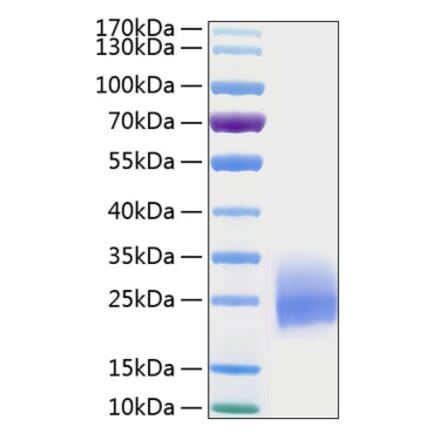 SDS-PAGE - Recombinant Human GM-CSF Protein (C-terminal His Tag) (A330712) - Antibodies.com