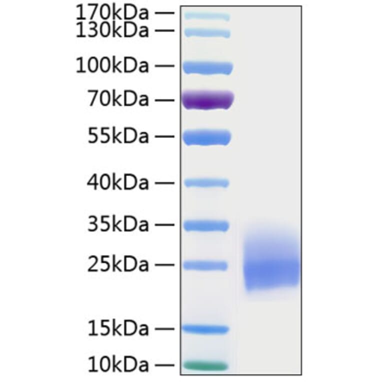 SDS-PAGE - Recombinant Human GM-CSF Protein (C-terminal His Tag) (A330712) - Antibodies.com