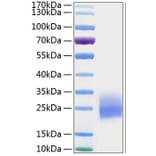 SDS-PAGE - Recombinant Human GM-CSF Protein (C-terminal His Tag) (A330712) - Antibodies.com