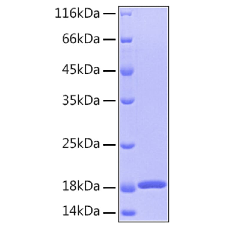 SDS-PAGE - Recombinant Human GMFB Protein (A330713) - Antibodies.com