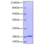 SDS-PAGE - Recombinant Human GMFB Protein (A330713) - Antibodies.com