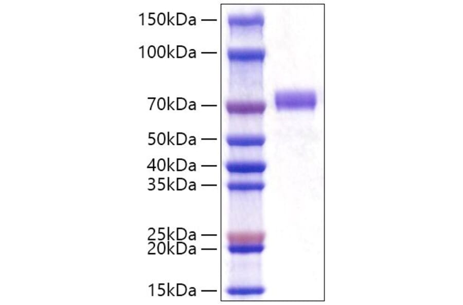 SDS-PAGE - Recombinant Human GOLPH2 Protein (C-terminal His Tag) (A330714) - Antibodies.com