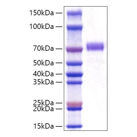 SDS-PAGE - Recombinant Human GOLPH2 Protein (C-terminal His Tag) (A330714) - Antibodies.com