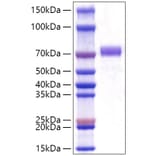 SDS-PAGE - Recombinant Human GOLPH2 Protein (C-terminal His Tag) (A330714) - Antibodies.com