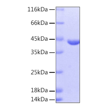 SDS-PAGE - Recombinant Human GOT1 Protein (A330715) - Antibodies.com
