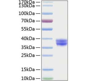 SDS-PAGE - Recombinant Human GPA33 Protein (C-terminal His Tag) (A330716) - Antibodies.com