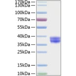 SDS-PAGE - Recombinant Human GPA33 Protein (C-terminal His Tag) (A330716) - Antibodies.com