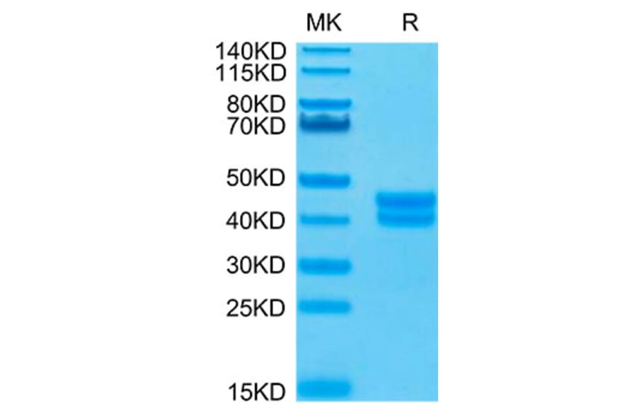 Tris-Bis PAGE - Recombinant Human GPA33 Protein (Biotin) (C-terminal His and Avi Tag) (A330717) - Antibodies.com