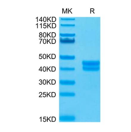 Tris-Bis PAGE - Recombinant Human GPA33 Protein (Biotin) (C-terminal His and Avi Tag) (A330717) - Antibodies.com