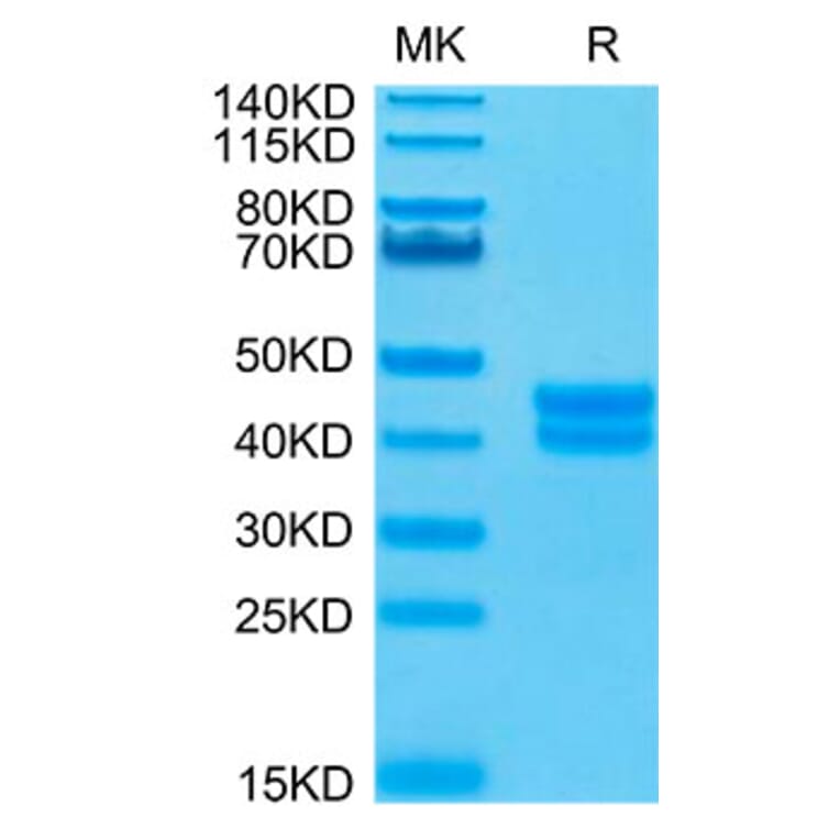 Tris-Bis PAGE - Recombinant Human GPA33 Protein (Biotin) (C-terminal His and Avi Tag) (A330717) - Antibodies.com