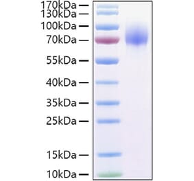 SDS-PAGE - Recombinant Human GPNMB Protein (C-terminal His Tag) (A330718) - Antibodies.com
