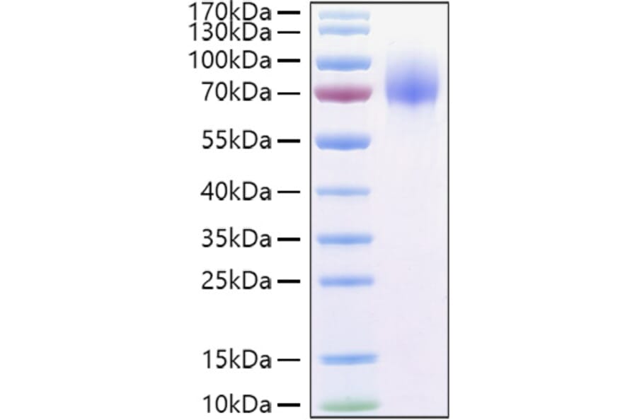 SDS-PAGE - Recombinant Human GPNMB Protein (C-terminal His Tag) (A330718) - Antibodies.com