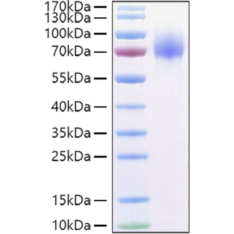 SDS-PAGE - Recombinant Human GPNMB Protein (C-terminal His Tag) (A330718) - Antibodies.com