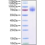 SDS-PAGE - Recombinant Human GPNMB Protein (C-terminal His Tag) (A330718) - Antibodies.com