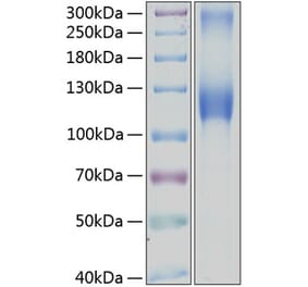 SDS-PAGE - Recombinant Human GPNMB Protein (C-terminal Human Fc and His Tag) (A330719) - Antibodies.com