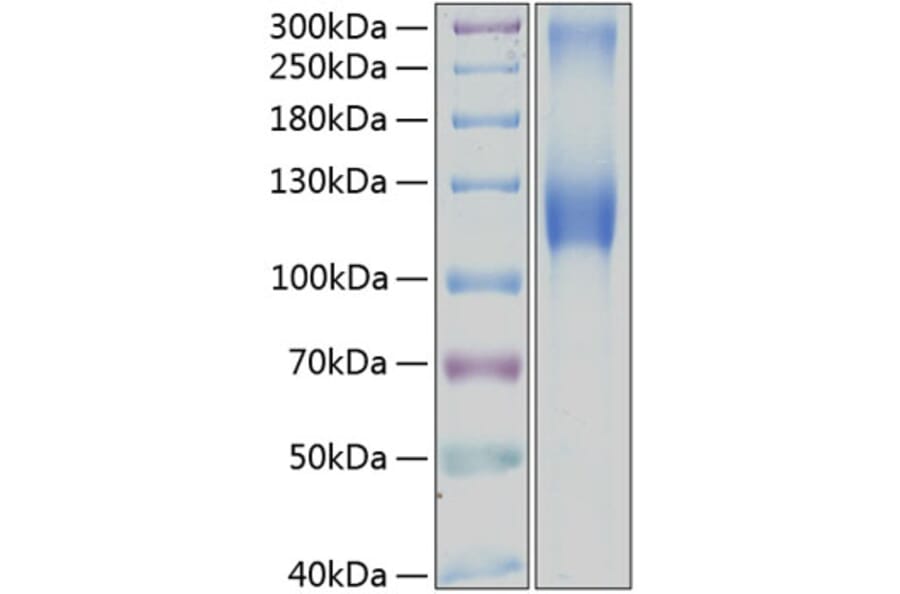 SDS-PAGE - Recombinant Human GPNMB Protein (C-terminal Human Fc and His Tag) (A330719) - Antibodies.com