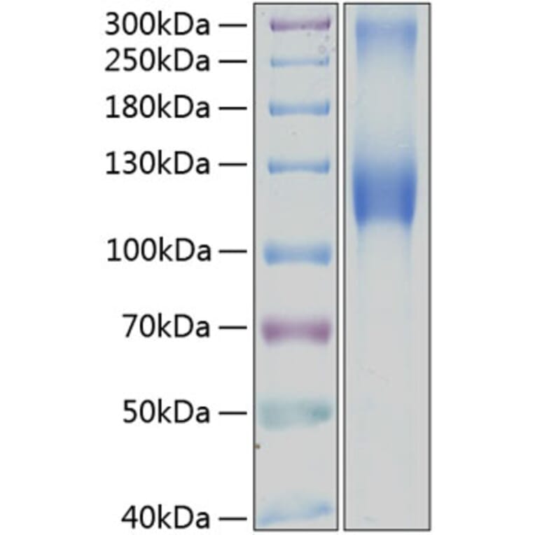 SDS-PAGE - Recombinant Human GPNMB Protein (C-terminal Human Fc and His Tag) (A330719) - Antibodies.com