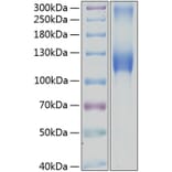 SDS-PAGE - Recombinant Human GPNMB Protein (C-terminal Human Fc and His Tag) (A330719) - Antibodies.com