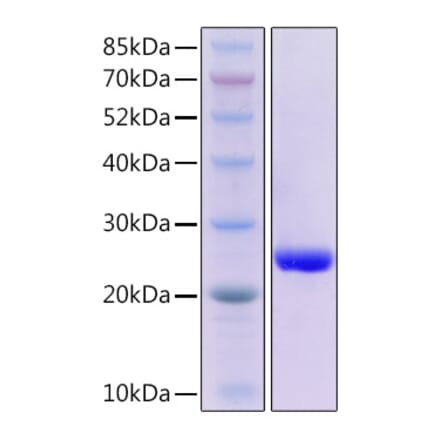 SDS-PAGE - Recombinant Human GPX4 Protein (N-terminal His Tag) (A330720) - Antibodies.com