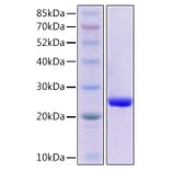SDS-PAGE - Recombinant Human GPX4 Protein (N-terminal His Tag) (A330720) - Antibodies.com