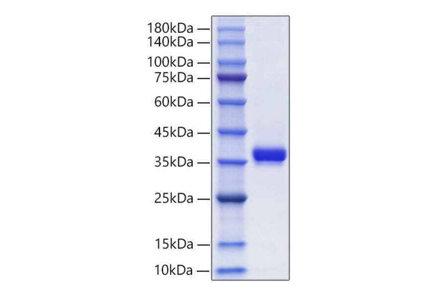 SDS-PAGE - Recombinant Human Granzyme B Protein (C-terminal His Tag) (A330722) - Antibodies.com