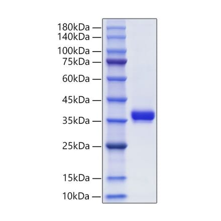 SDS-PAGE - Recombinant Human Granzyme B Protein (C-terminal His Tag) (A330722) - Antibodies.com