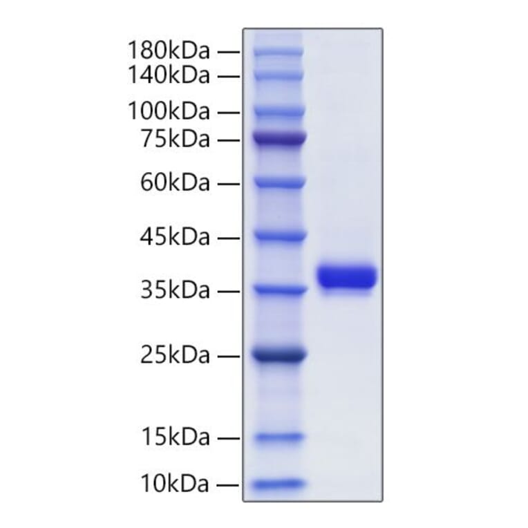SDS-PAGE - Recombinant Human Granzyme B Protein (C-terminal His Tag) (A330722) - Antibodies.com