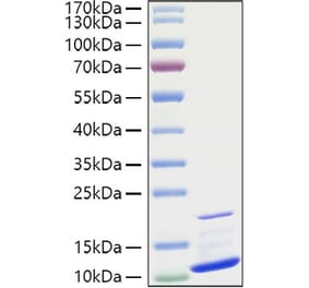 SDS-PAGE - Recombinant Human GRO gamma Protein (A330723) - Antibodies.com